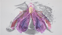 SUperposition d'une peinture rose de Clitoris et d'une planche anatomique noire et blanche de 1861